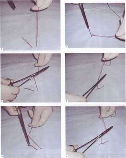 Как завязать хирургический узел для фидера (на леске), схема вязания для рыбалки