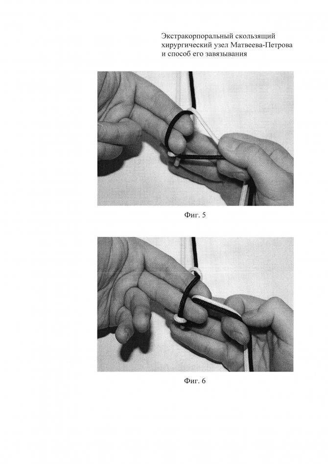 Как завязать хирургический узел для фидера (на леске), схема вязания для рыбалки: освещаем детально