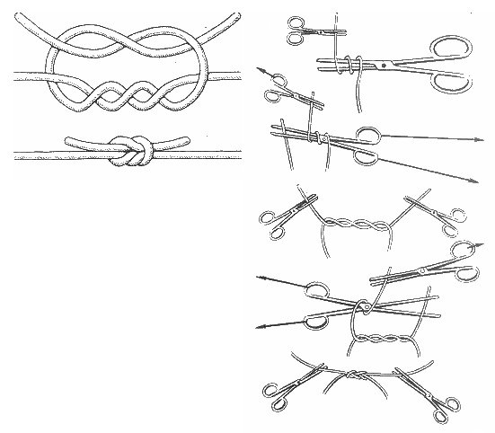 Каким узлом правильно привязывать карабин к леске? - суперулов - интернет-портал о рыбалке