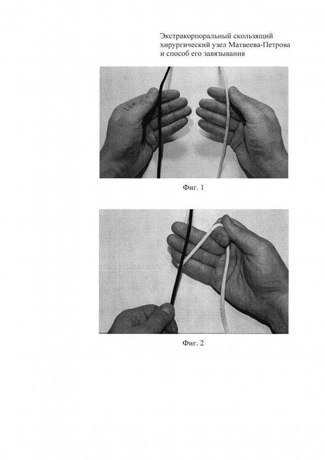 Хирургический узел, техника вязания и виды материалов