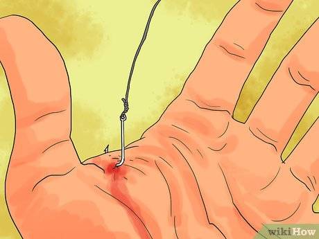 Как вытащить крючок из пальца и как не попасть на крючок