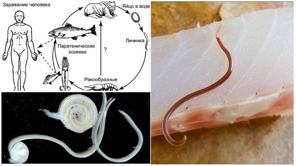 Опасные и безопасные червяки в рыбе для организма человека