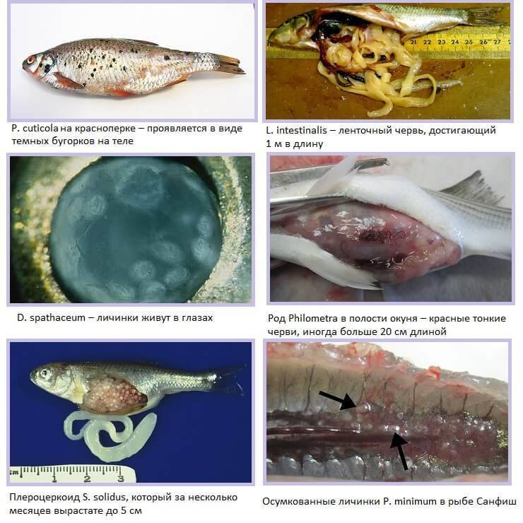 Описторхоз в рыбе картинки