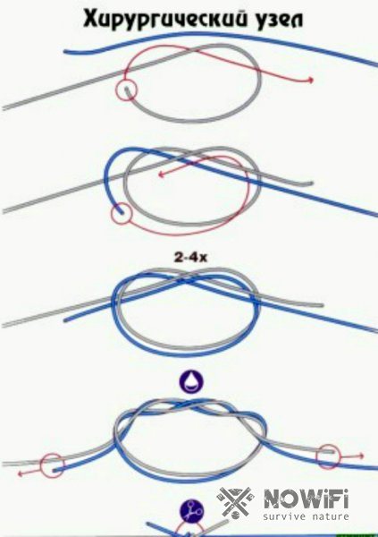 Хирургический узел для фидера: основные элементы вязки