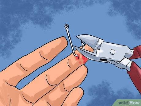 Как вытащить крючок тройника из пальца